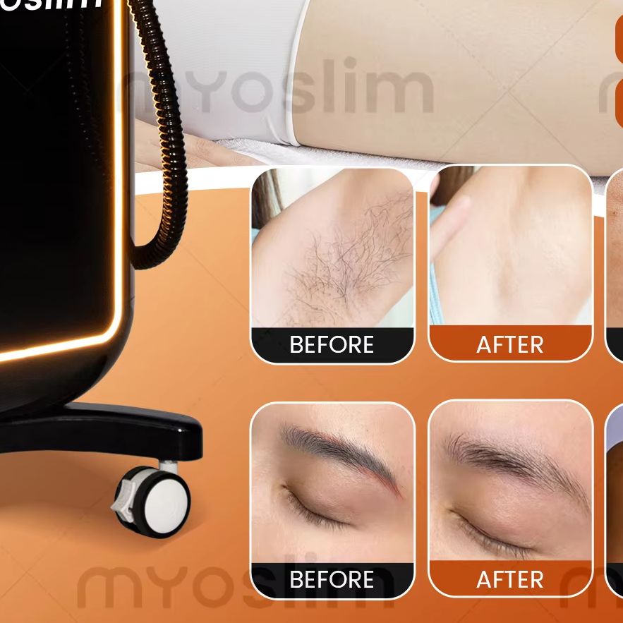 Hair Care Or Haircare - Çok Fonksiyonlu 4'ü 1 Arada Diyot