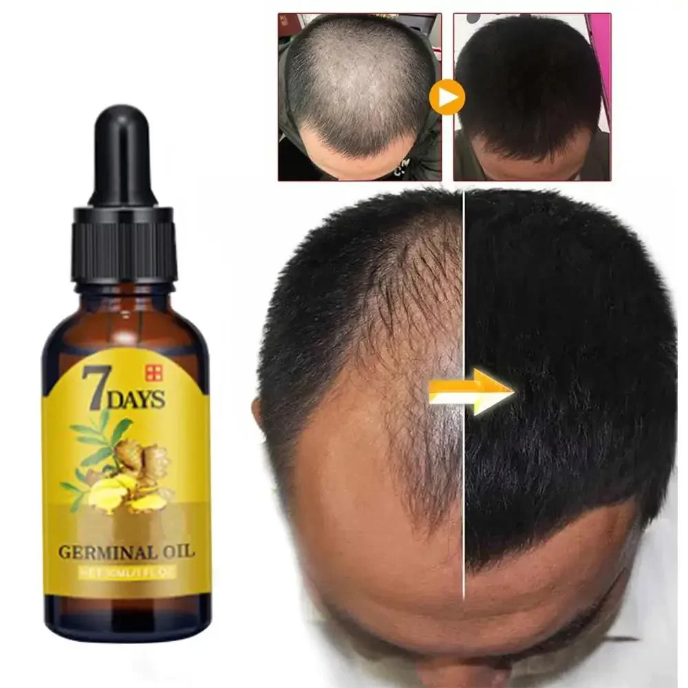 Hair Care Fragrance Essential Oil - Saç Büyüme Zencefil Hızlı Büyüyen Saç