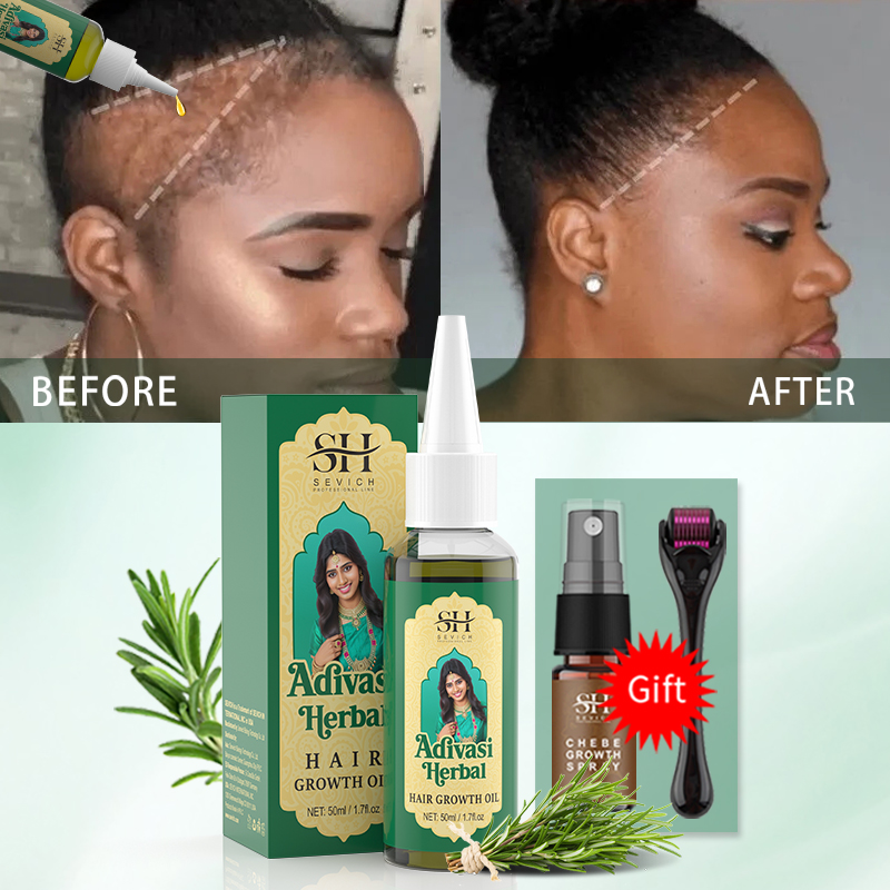 Ayurveda Saç Uzatma Yağı Hindi - Hair Care Fragrance Essential Oil incelemesi ve fiyatı