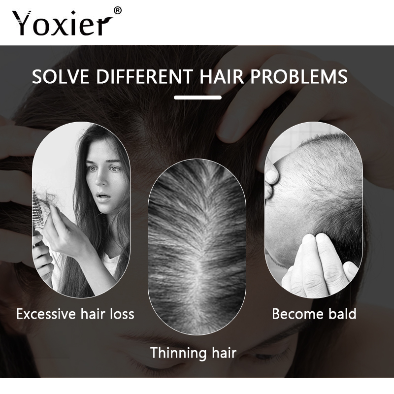 Yoğun büyüme serumu önlemek sa - Hair Care Serum incelemesi ve fiyatı