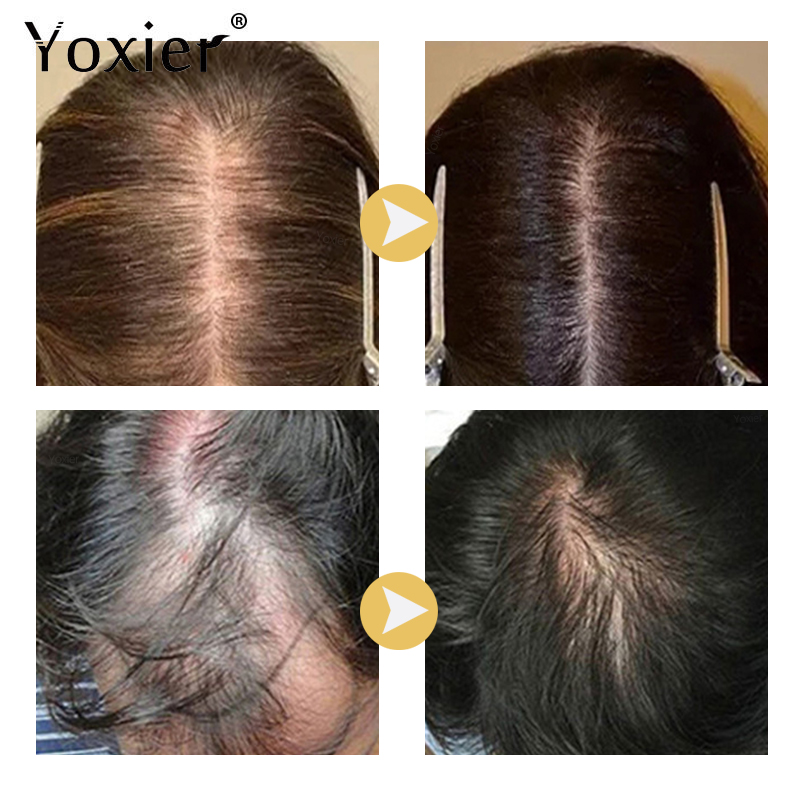 Yoğun büyüme serumu önlemek sa - Hair Care Serum incelemesi ve fiyatı
