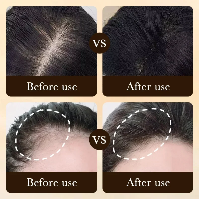 Biotin Hızlı Saç Uzatma Yağı Ü - Hair Care Fragrance Essential Oil incelemesi ve fiyatı