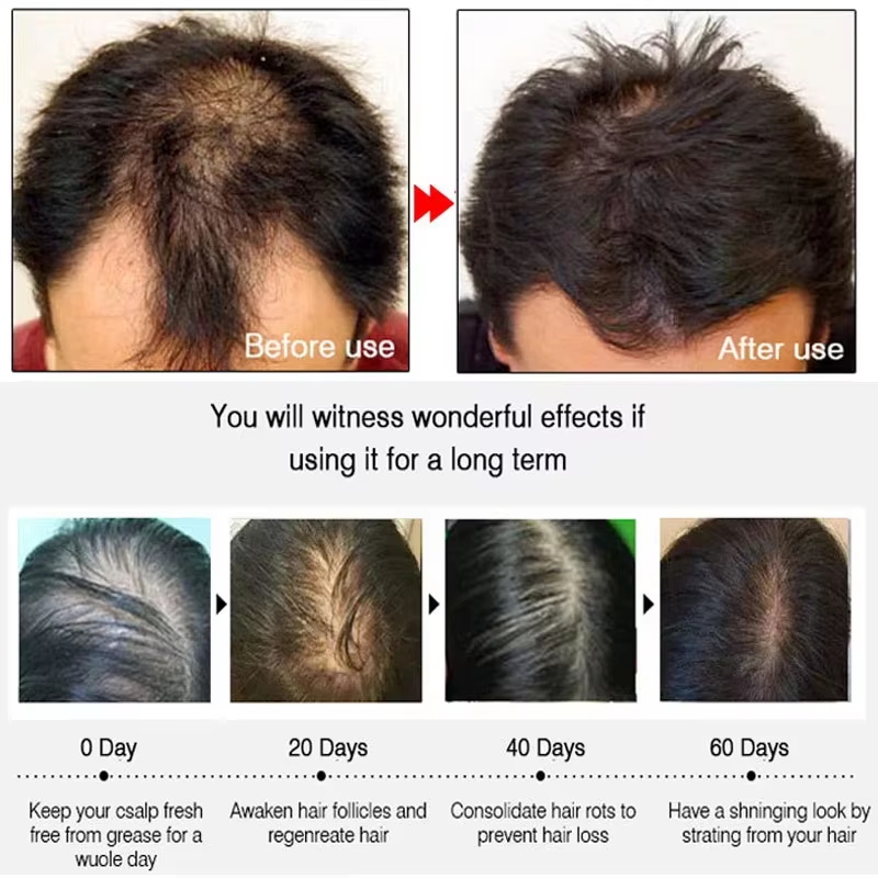 Hızlı Zencefilli Saç Uzatma Sp - Hair Care Serum incelemesi ve fiyatı