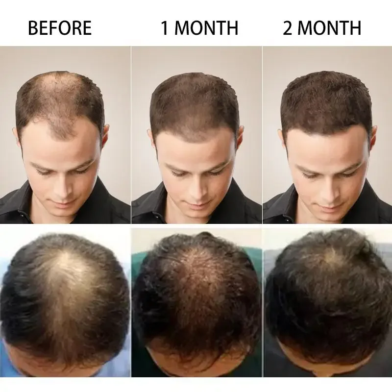 Saç Büyüme Zencefil Hızlı Büyü - Hair Care Fragrance Essential Oil incelemesi ve fiyatı